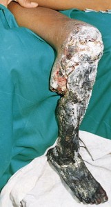 Terciopelo-Lanzenotter – Die giftigste Schlange Costa Ricas