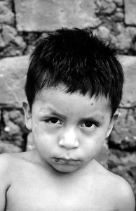 Chargas Befall Kind Mittelamerika Südamerika